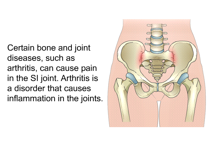 Certain bone and joint diseases, such as arthritis, can cause pain in the SI joint. Arthritis is a disorder that causes inflammation in the joints.