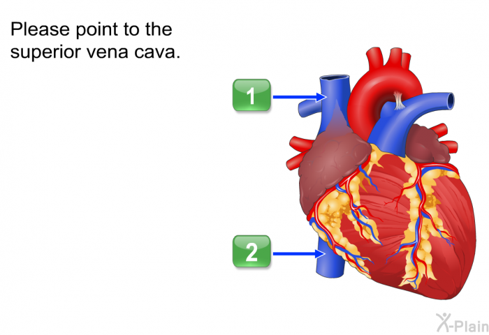 Please point to the superior vena cava.