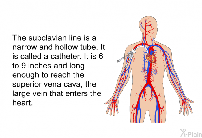 The subclavian line is a narrow and hollow tube. It is called a catheter. It is 6 to 9 inches and long enough to reach the superior vena cava, the large vein that enters the heart.