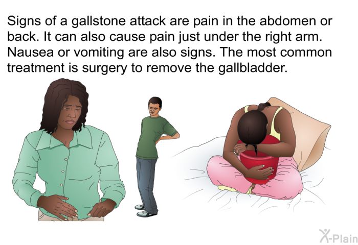 Signs of a gallstone attack are pain in the abdomen or back. It can also cause pain just under the right arm. Nausea or vomiting are also signs. The most common treatment is surgery to remove the gallbladder.