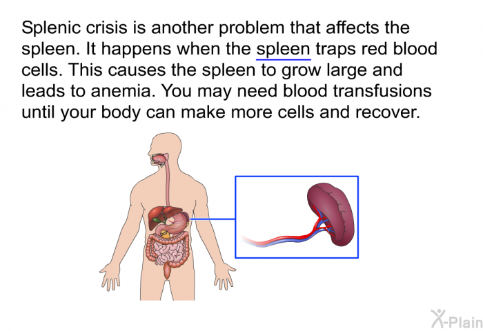 Splenic crisis is another problem that affects the spleen. It happens when the spleen traps red blood cells. This causes the spleen to grow large and leads to anemia. You may need blood transfusions until your body can make more cells and recover.