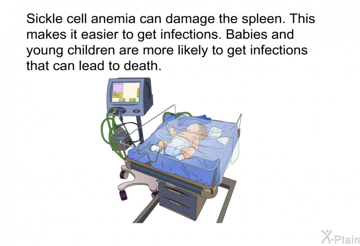Sickle cell anemia can damage the spleen. This makes it easier to get infections. Babies and young children are more likely to get infections that can lead to death.