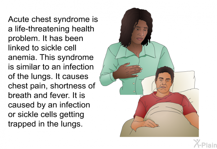 Acute chest syndrome is a life-threatening health problem. It has been linked to sickle cell anemia. This syndrome is similar to an infection of the lungs. It causes chest pain, shortness of breath and fever. It is caused by an infection or sickle cells getting trapped in the lungs.