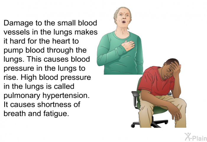 Damage to the small blood vessels in the lungs makes it hard for the heart to pump blood through the lungs. This causes blood pressure in the lungs to rise. High blood pressure in the lungs is called pulmonary hypertension. It causes shortness of breath and fatigue.