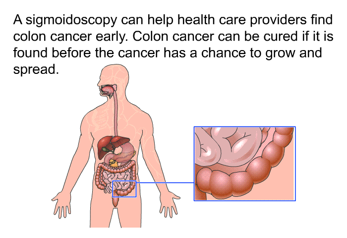 A sigmoidoscopy can help health care providers find colon cancer early. Colon cancer can be cured if it is found before the cancer has a chance to grow and spread.