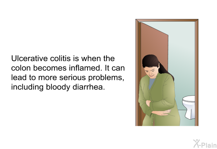 Ulcerative colitis is when the colon becomes inflamed. It can lead to more serious problems, including bloody diarrhea.