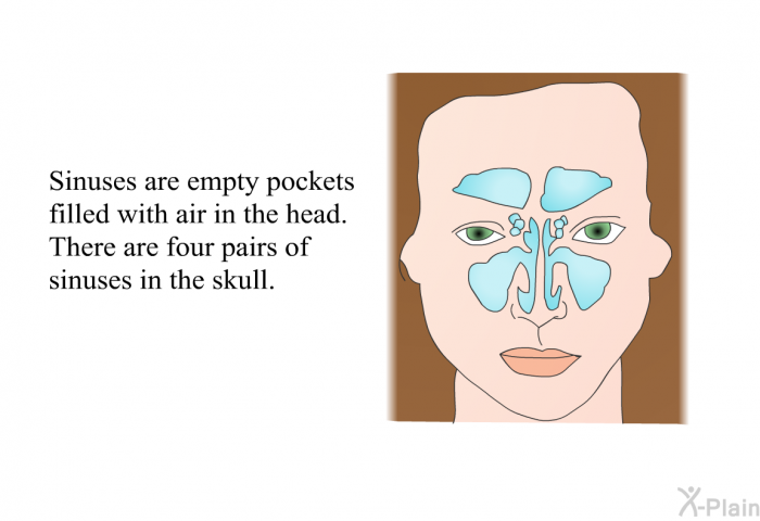 Sinuses are empty pockets filled with air in the head. There are four pairs of sinuses in the skull.