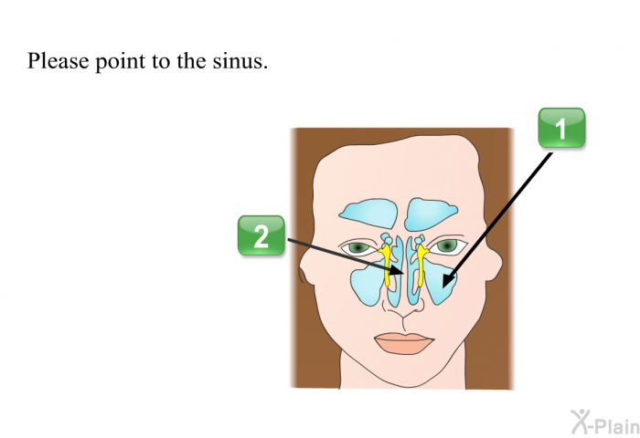 Please point to the sinus.