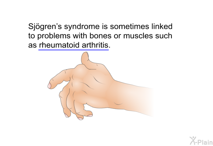 Sjögren's syndrome is sometimes linked to problems with bones or muscles such as rheumatoid arthritis.