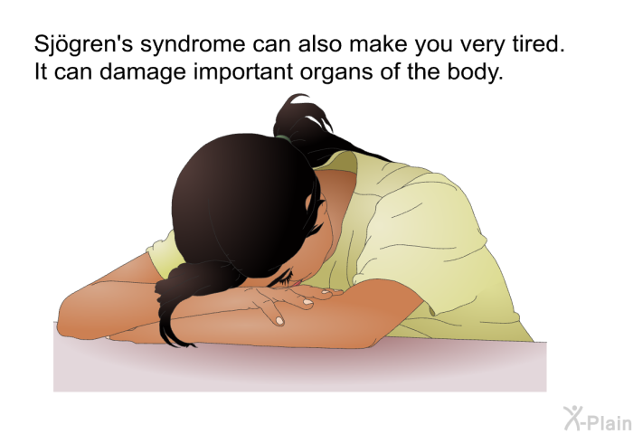 Sjögren's syndrome can also make you very tired. It can damage important organs of the body.
