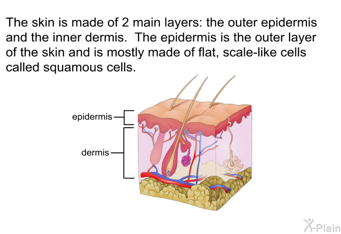 The skin is made of 2 main layers: the outer epidermis and the inner dermis. The epidermis is the outer layer of the skin and is mostly made of flat, scale-like cells called squamous cells.