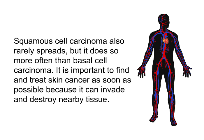 Squamous cell carcinoma also rarely spreads, but it does so more often than basal cell carcinoma. It is important to find and treat skin cancer as soon as possible because it can invade and destroy nearby tissue.