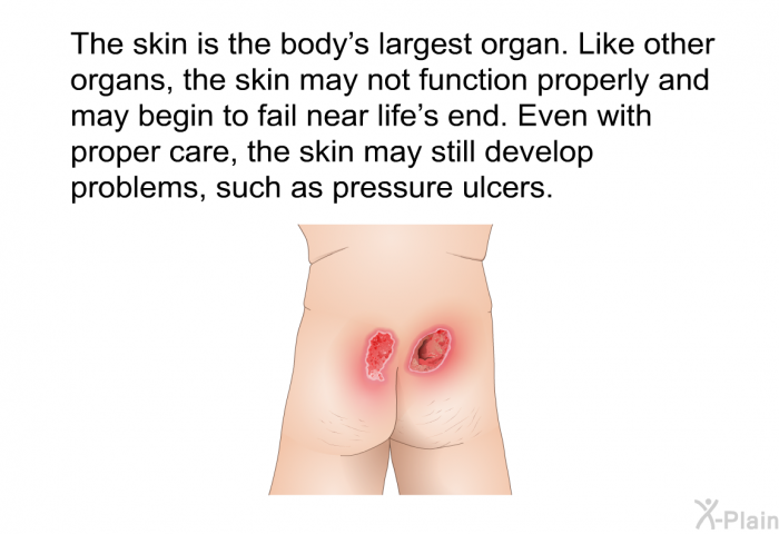 The skin is the body's largest organ. Like other organs, the skin may not function properly and may begin to fail near life's end. Even with proper care, the skin may still develop problems, such as pressure ulcers.