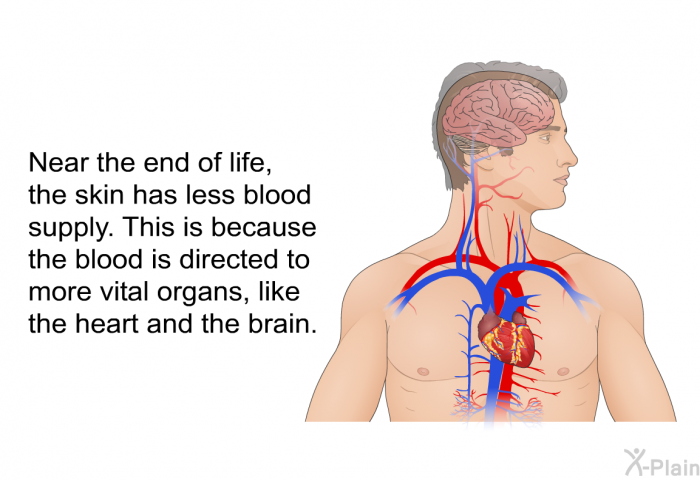 Near the end of life, the skin has less blood supply. This is because the blood is directed to more vital organs, like the heart and the brain.