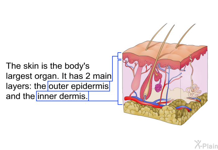 The skin is the body's largest organ. It has 2 main layers: the outer epidermis and the inner dermis.