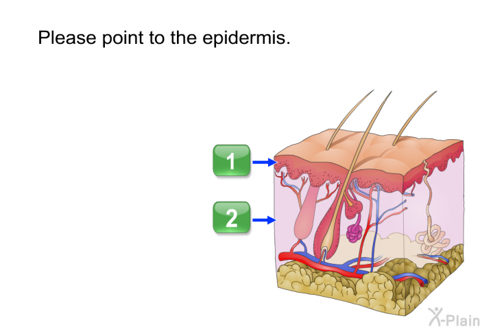 Please point to the epidermis.