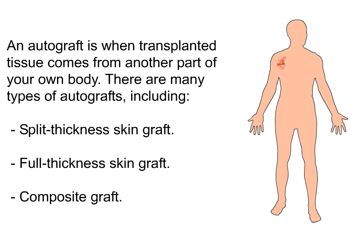 An autograft is when transplanted tissue comes from another part of your own body. There are many types of autografts, including:  Split-thickness skin graft. Full-thickness skin graft. Composite graft.