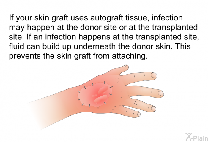 If your skin graft uses autograft tissue, infection may happen at the donor site or at the transplanted site. If an infection happens at the transplanted site, fluid can build up underneath the donor skin. This prevents the skin graft from attaching.