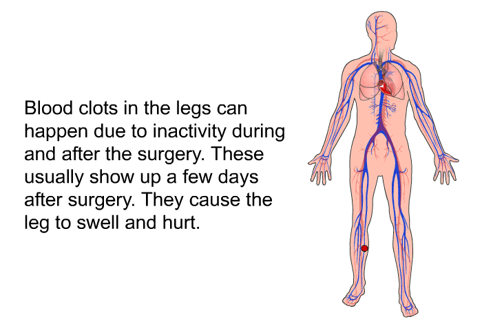 Blood clots in the legs can happen due to inactivity during and after the surgery. These usually show up a few days after surgery. They cause the leg to swell and hurt.