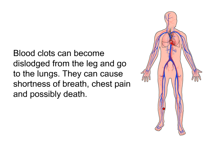 Blood clots can become dislodged from the leg and go to the lungs. They can cause shortness of breath, chest pain and possibly death.