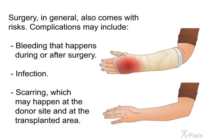 Surgery, in general, also comes with risks. Complications may include:  Bleeding that happens during or after surgery. Infection. Scarring, which may happen at the donor site and at the transplanted area.