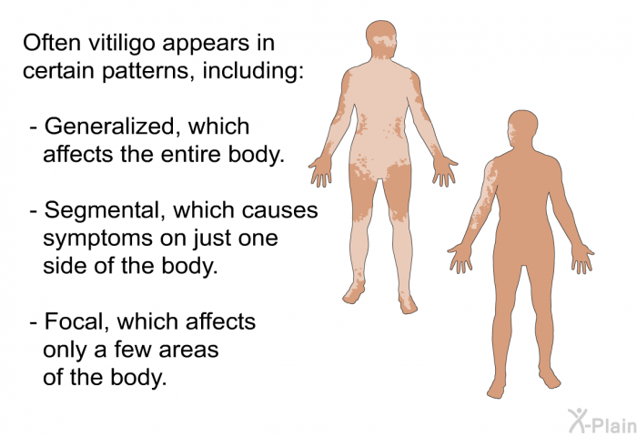 Often vitiligo appears in certain patterns, including:  Generalized, which affects the entire body. Segmental, which causes symptoms on just one side of the body. Focal, which affects only a few areas of the body.