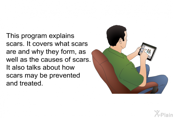 This health information explains scars. It covers what scars are and why they form, as well as the causes of scars. It also talks about how scars may be prevented and treated.