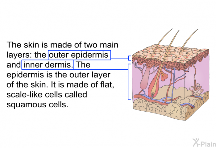 The skin is made of two main layers: the outer epidermis and inner dermis. The epidermis is the outer layer of the skin. It is made of flat, scale-like cells called squamous cells.