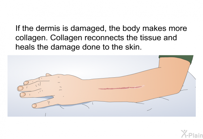 If the dermis is damaged, the body makes more collagen. Collagen reconnects the tissue and heals the damage done to the skin.