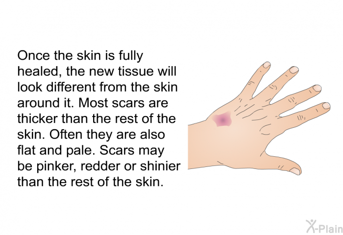 Once the skin is fully healed, the new tissue will look different from the skin around it. Most scars are thicker than the rest of the skin. Often they are also flat and pale. Scars may be pinker, redder or shinier than the rest of the skin.