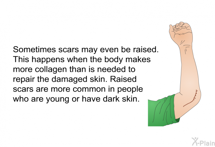 Sometimes scars may even be raised. This happens when the body makes more collagen than is needed to repair the damaged skin. Raised scars are more common in people who are young or have dark skin.