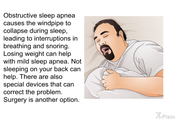 Obstructive sleep apnea causes the windpipe to collapse during sleep, leading to interruptions in breathing and snoring. Losing weight can help with mild sleep apnea. Not sleeping on your back can help. There are also special devices that can correct the problem. Surgery is another option.