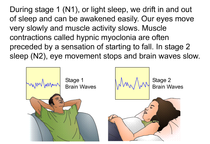 During stage 1 (N1), or light sleep, we drift in and out of sleep and can be awakened easily. Our eyes move very slowly and muscle activity slows. Muscle contractions called <I>hypnic myoclonia</I> are often preceded by a sensation of starting to fall. In stage 2 sleep (N2), eye movement stops and brain waves slow<I>.</I>