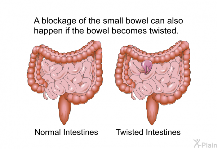A blockage of the small bowel can also happen if the bowel becomes twisted.