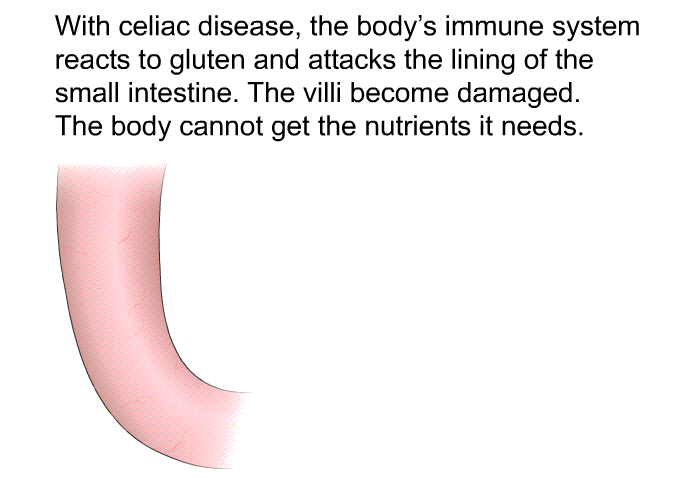With celiac disease, the body's immune system reacts to gluten and attacks the lining of the small intestine. The villi become damaged. The body cannot get the nutrients it needs.