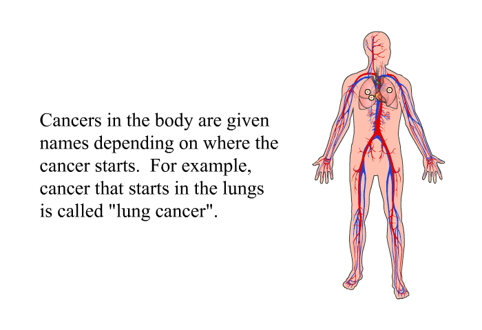 Cancers in the body are given names depending on where the cancer starts. For example, cancer that starts in the lungs is called “lung cancer”.