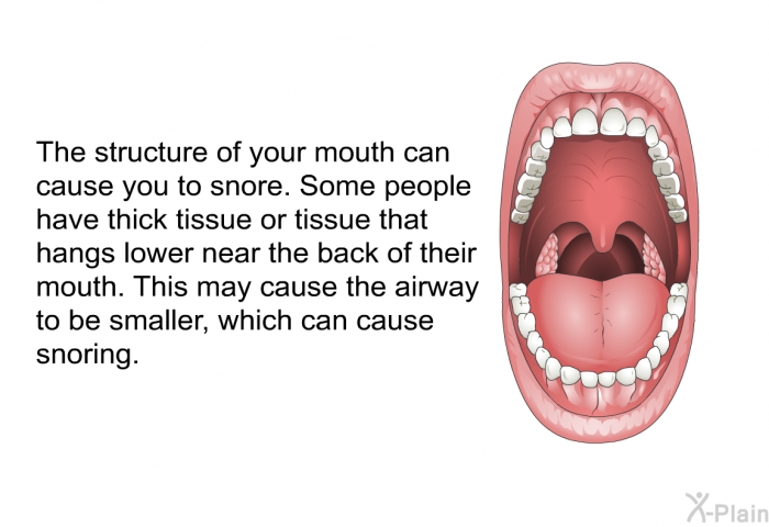 The structure of your mouth can cause you to snore. Some people have thick tissue or tissue that hangs lower near the back of their mouth. This may cause the airway to be smaller, which can cause snoring.