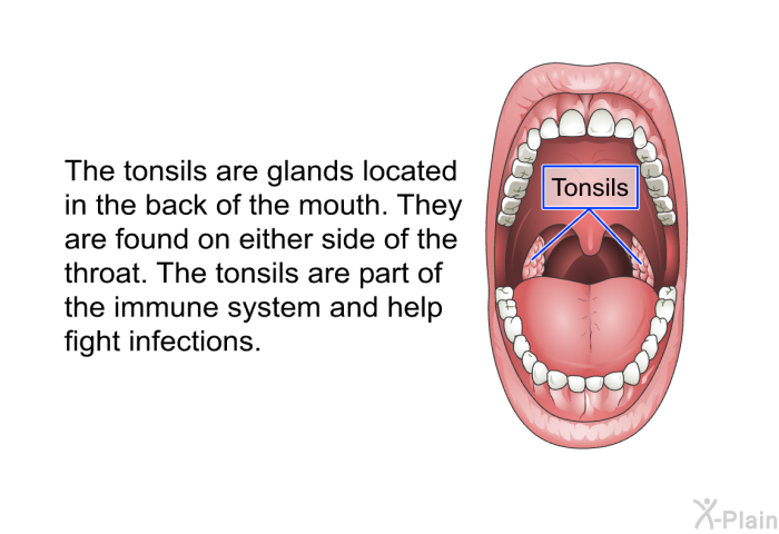 The tonsils are glands located in the back of the mouth. They are found on either side of the throat. The tonsils are part of the immune system and help fight infections.