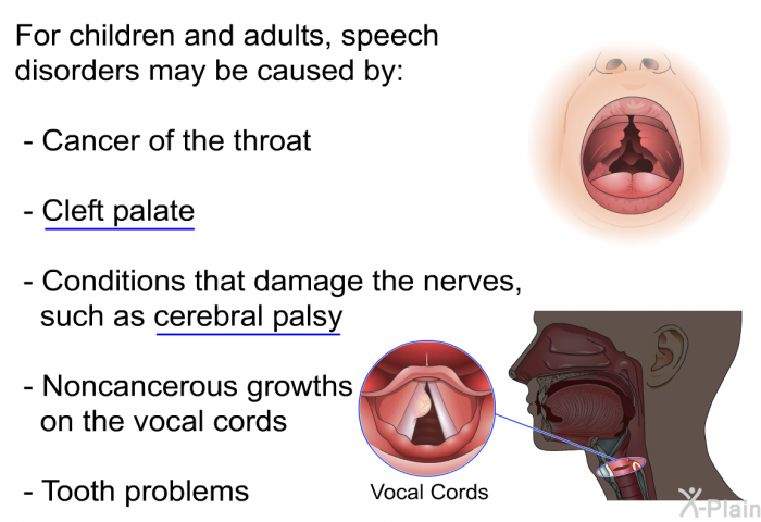 For children and adults, speech disorders may be caused by:  Cancer of the throat Cleft palate Conditions that damage the nerves, such as cerebral palsy Noncancerous growths on the vocal cords Tooth problems