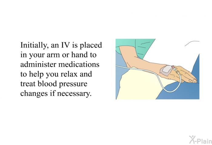 Initially, an IV is placed in your arm or hand to administer medications to help you relax and treat blood pressure changes if necessary.