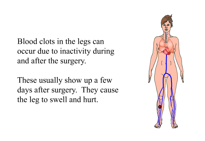 Blood clots in the legs can occur due to inactivity during and after the surgery. These usually show up a few days after surgery. They cause the leg to swell and hurt.