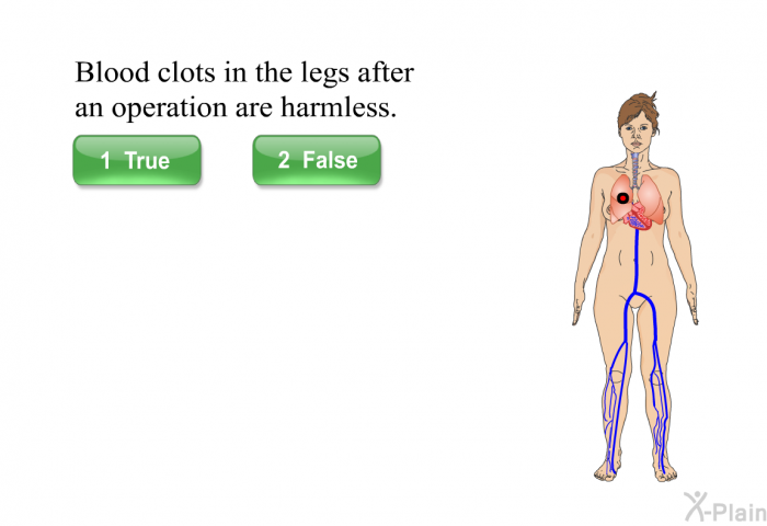Blood clots in the legs after an operation are harmless.