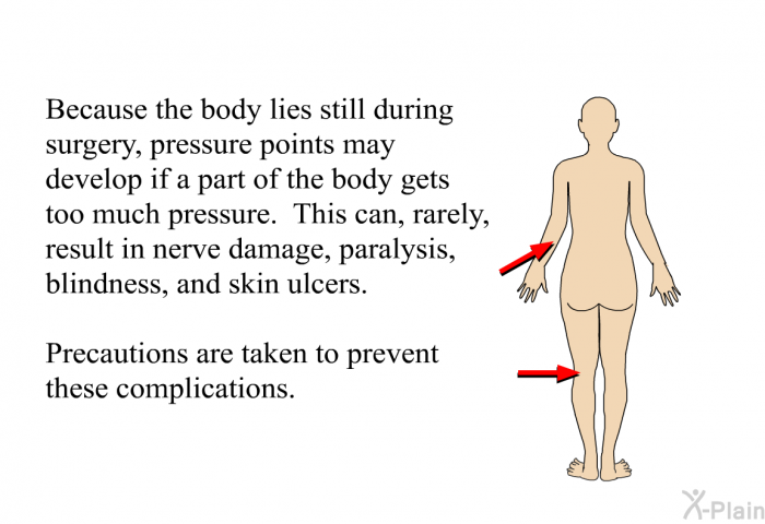 Because the body lies still during surgery, pressure points may develop if a part of the body gets too much pressure. This can, rarely, result in nerve damage, paralysis, blindness, and skin ulcers. Precautions are taken to prevent these complications.