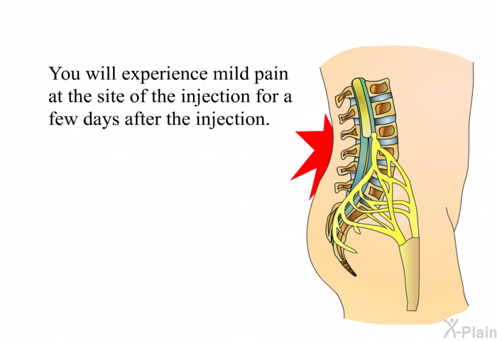 You will experience mild pain at the site of the injection for a few days after the injection.