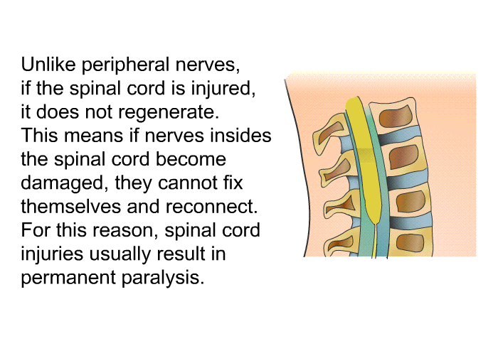 Unlike peripheral nerves, if the spinal cord is injured, it does not regenerate. This means if nerves insides the spinal cord become damaged, they cannot fix themselves and reconnect. For this reason, spinal cord injuries usually result in permanent paralysis.
