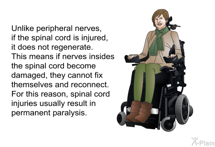 Unlike peripheral nerves, if the spinal cord is injured, it does not regenerate. This means if nerves insides the spinal cord become damaged, they cannot fix themselves and reconnect. For this reason, spinal cord injuries usually result in permanent paralysis.