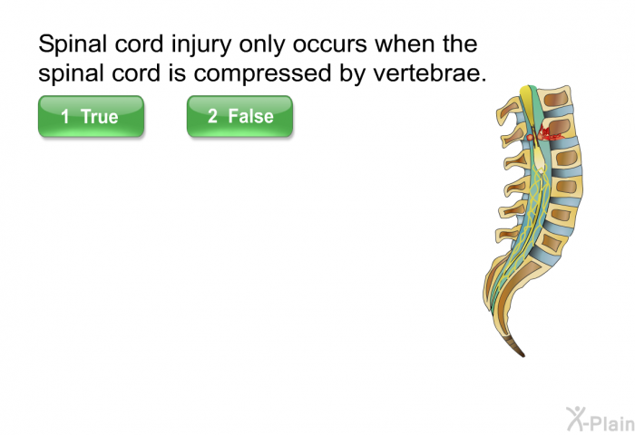 Spinal cord injury <u><b>only</b></u> occurs when the spinal cord is compressed by vertebrae.