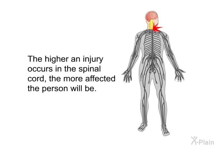 The higher an injury occurs in the spinal cord, the more affected the person will be.