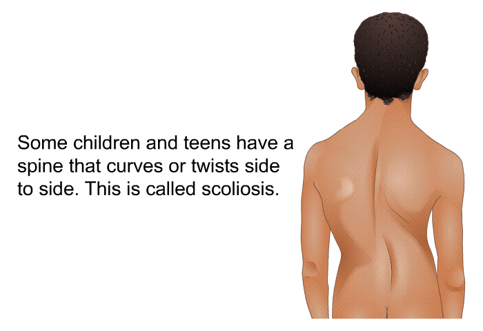 Some children and teens have a spine that curves or twists side to side. This is called scoliosis.