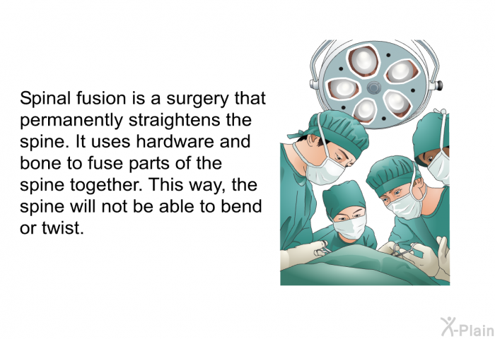 Spinal fusion is a surgery that permanently straightens the spine. It uses hardware and bone to fuse parts of the spine together. This way, the spine will not be able to bend or twist.